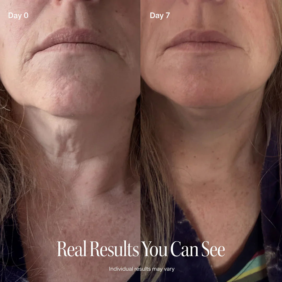 SILVLIFELABS NECK FIRMING CREAM