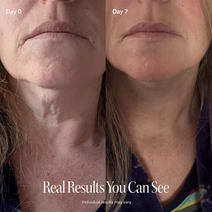 SILVLIFELABS NECK FIRMING CREAM