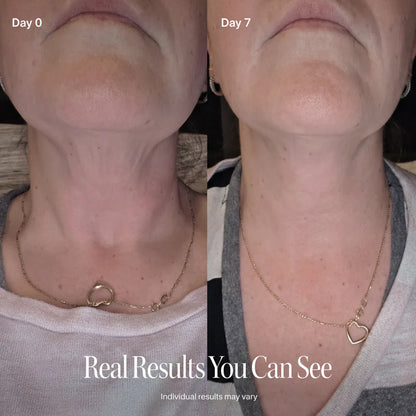 SILVLIFELABS NECK FIRMING CREAM