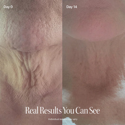 SILVLIFELABS NECK FIRMING CREAM