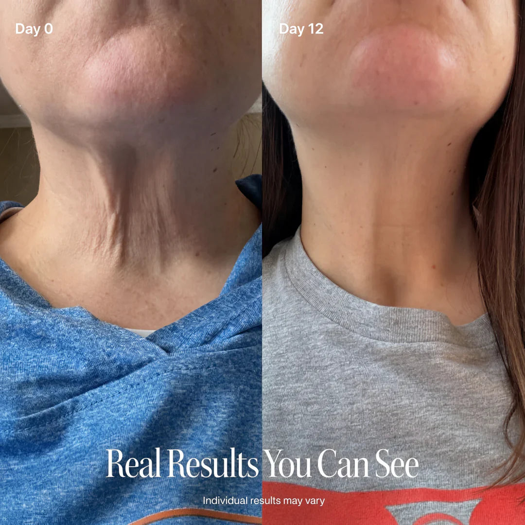 SILVLIFELABS NECK FIRMING CREAM