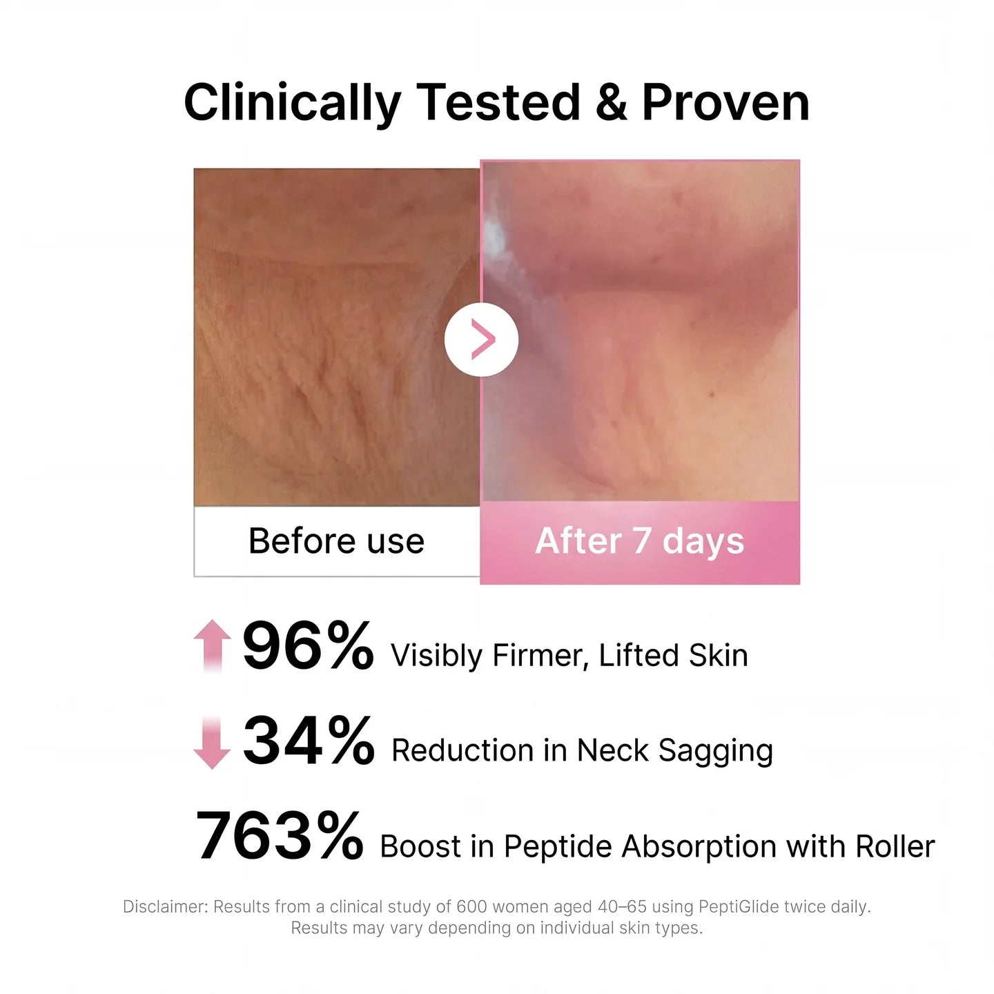 SILVLIFELABS NECK FIRMING CREAM